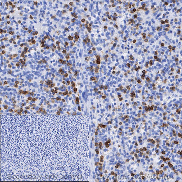 Immunohistochemistry (Formalin/PFA-fixed paraffin-embedded sections) - Anti-CD3 epsilon antibody [EP449E] (AB52959)