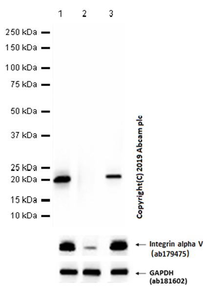 Western blot - Anti-CD3 epsilon antibody [EP449E] (AB52959), expandable thumbnail