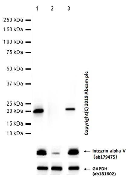 Western blot - Anti-CD3 epsilon antibody [EP449E] (AB52959)
