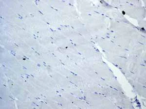 Immunohistochemistry (Formalin/PFA-fixed paraffin-embedded sections) - Anti-CD3 epsilon antibody [EP449E] - BSA and Azide free (AB271850)