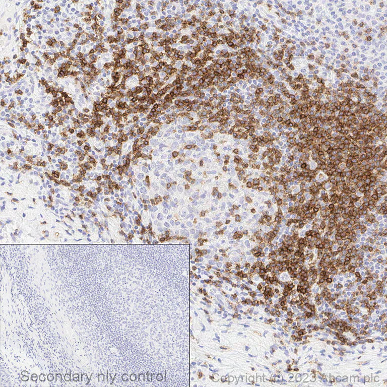 Immunohistochemistry (Formalin/PFA-fixed paraffin-embedded sections) - Anti-CD3 epsilon antibody [EP449E] - BSA and Azide free (AB271850)