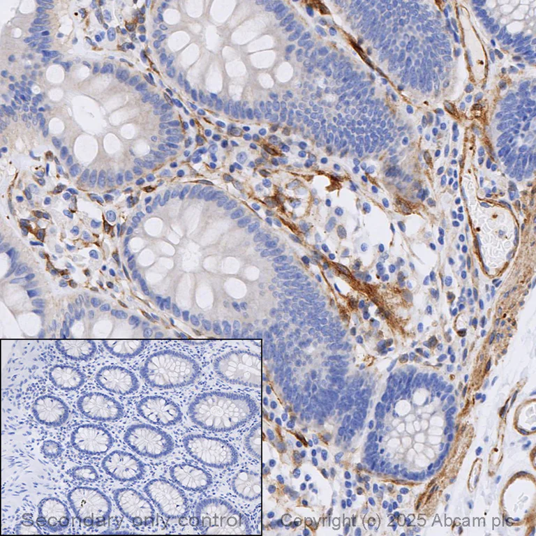 Immunohistochemistry (Formalin/PFA-fixed paraffin-embedded sections) - Anti-CD3 epsilon antibody [EP449E] - BSA and Azide free (AB271850)