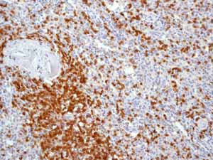 Immunohistochemistry (Formalin/PFA-fixed paraffin-embedded sections) - Anti-CD3 epsilon antibody [EP449E] - Low endotoxin, Azide free (AB213608), expandable thumbnail