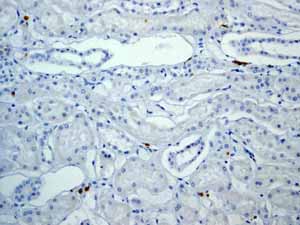 Immunohistochemistry (Formalin/PFA-fixed paraffin-embedded sections) - Anti-CD3 epsilon antibody [EP449E] - Low endotoxin, Azide free (ab213608), expandable thumbnail