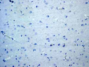 Immunohistochemistry (Formalin/PFA-fixed paraffin-embedded sections) - Anti-CD3 epsilon antibody [EP449E] - Low endotoxin, Azide free (AB213608), expandable thumbnail