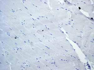 Immunohistochemistry (Formalin/PFA-fixed paraffin-embedded sections) - Anti-CD3 epsilon antibody [EP449E] - Low endotoxin, Azide free (ab213608), expandable thumbnail