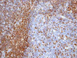 Immunohistochemistry (Formalin/PFA-fixed paraffin-embedded sections) - Anti-CD3 epsilon antibody [EP449E] - Low endotoxin, Azide free (AB213608), expandable thumbnail