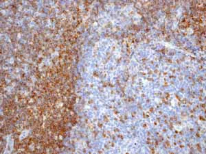 Immunohistochemistry (Formalin/PFA-fixed paraffin-embedded sections) - Anti-CD3 epsilon antibody [EP449E] - Low endotoxin, Azide free (AB213608)