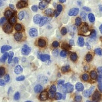 Immunohistochemistry (Formalin/PFA-fixed paraffin-embedded sections) - Anti-CD3 epsilon antibody [EP449E] - Low endotoxin, Azide free (AB213608), expandable thumbnail