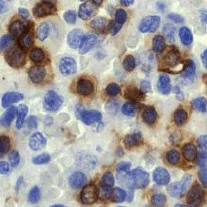 Immunohistochemistry (Formalin/PFA-fixed paraffin-embedded sections) - Anti-CD3 epsilon antibody [EP449E] - Low endotoxin, Azide free (AB213608)