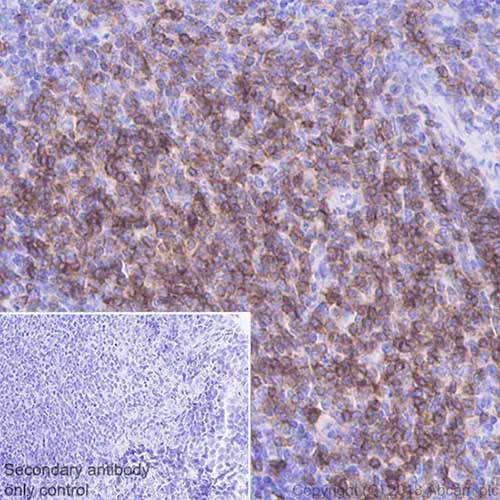 Immunohistochemistry (Formalin/PFA-fixed paraffin-embedded sections) - Anti-CD3 epsilon antibody [EPR20752] (AB215212)