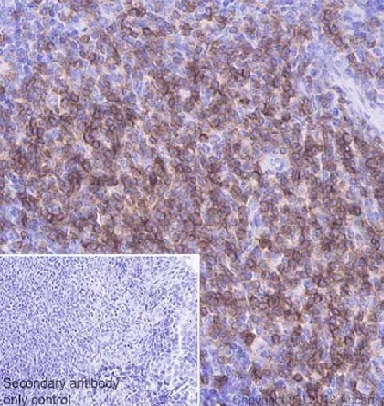 Immunohistochemistry (Formalin/PFA-fixed paraffin-embedded sections) - Anti-CD3 epsilon antibody [EPR20752] - BSA and Azide free (AB231830), expandable thumbnail