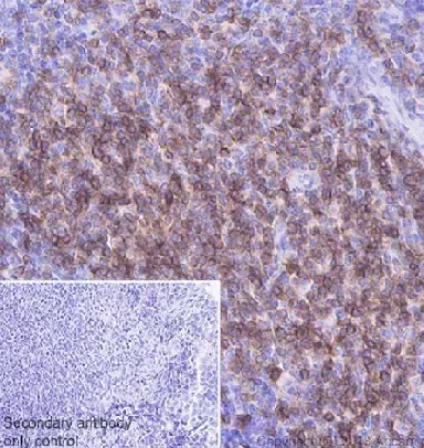 Immunohistochemistry (Formalin/PFA-fixed paraffin-embedded sections) - Anti-CD3 epsilon antibody [EPR20752] - BSA and Azide free (AB231830)