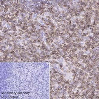 Immunohistochemistry (Formalin/PFA-fixed paraffin-embedded sections) - Anti-CD3 epsilon antibody [EPR20752] - BSA and Azide free (AB231830), expandable thumbnail