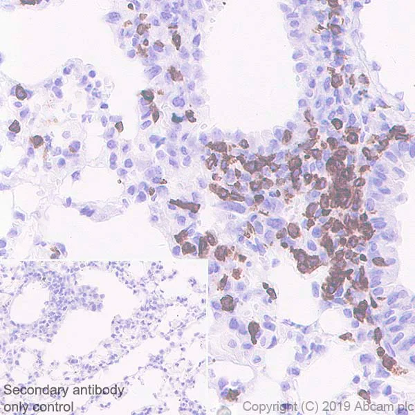 Immunohistochemistry (Formalin/PFA-fixed paraffin-embedded sections) - Anti-CD3 epsilon antibody [EPR22667-12] - BSA and Azide free (AB255697)