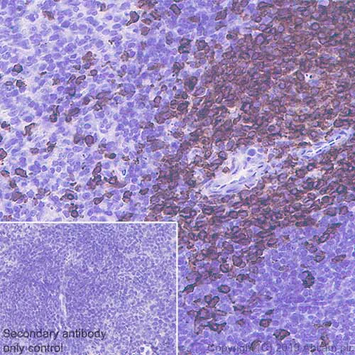 Immunohistochemistry (Formalin/PFA-fixed paraffin-embedded sections) - Anti-CD3 epsilon antibody [EPR22667-12] - BSA and Azide free (AB255697)
