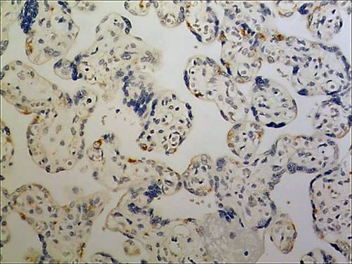 Immunohistochemistry (Formalin/PFA-fixed paraffin-embedded sections) - Anti-CD3 epsilon antibody [MM0167-3F43] (AB89205)
