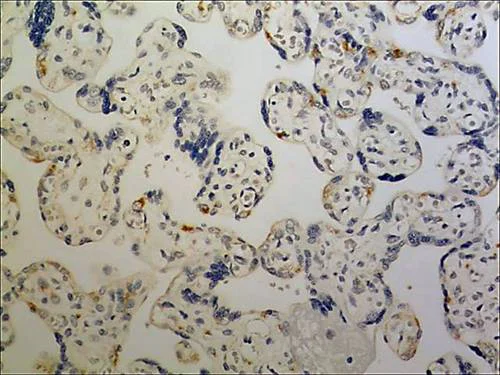 Immunohistochemistry (Formalin/PFA-fixed paraffin-embedded sections) - Anti-CD3 epsilon antibody [MM0167-3F43] (AB89205)
