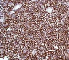 Immunohistochemistry (Formalin/PFA-fixed paraffin-embedded sections) - CD3 epsilon Antibody Panel (E272, EP449E, CAL54) (AB252198)