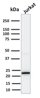 Western blot - Anti-CD3 epsilon antibody [PC3/188A] (AB219328)