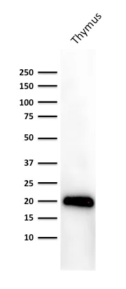 Western blot - Anti-CD3 epsilon antibody [PC3/188A] (AB219328)