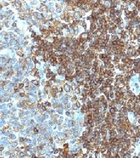 Immunohistochemistry (Formalin/PFA-fixed paraffin-embedded sections) - Anti-CD3 epsilon antibody [PC3/188A] - BSA and Azide free (AB269766)