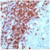 Immunohistochemistry (Formalin/PFA-fixed paraffin-embedded sections) - Anti-CD3 epsilon antibody, prediluted (AB27434)