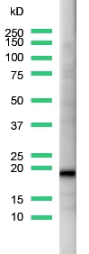 Western blot - Anti-CD3 epsilon antibody, prediluted (AB27434)