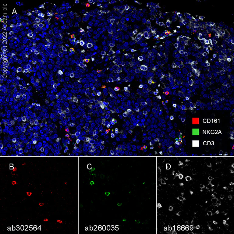 Multiplex immunohistochemistry - Anti-CD3 epsilon antibody [SP7] (AB16669)