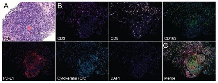 Immunohistochemistry (Formalin/PFA-fixed paraffin-embedded sections) - Anti-CD3 epsilon antibody [SP7] - BSA and Azide free (AB205228)