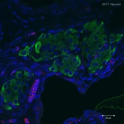 Immunohistochemistry (Formalin/PFA-fixed paraffin-embedded sections) - Anti-CD3 epsilon antibody [SP7] - BSA and Azide free (AB205228)