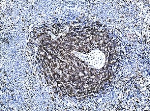 Immunohistochemistry (Formalin/PFA-fixed paraffin-embedded sections) - Anti-CD3 epsilon antibody [SP7] - BSA and Azide free (AB205228)