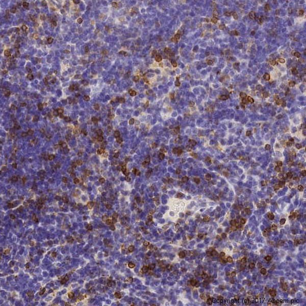 Immunohistochemistry (Formalin/PFA-fixed paraffin-embedded sections) - Anti-CD3 epsilon antibody [SP7] - BSA and Azide free (ab205228), expandable thumbnail