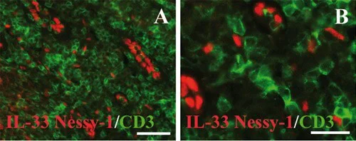 Immunohistochemistry (Formalin/PFA-fixed paraffin-embedded sections) - Anti-CD3 epsilon antibody [SP7] - BSA and Azide free (AB205228)