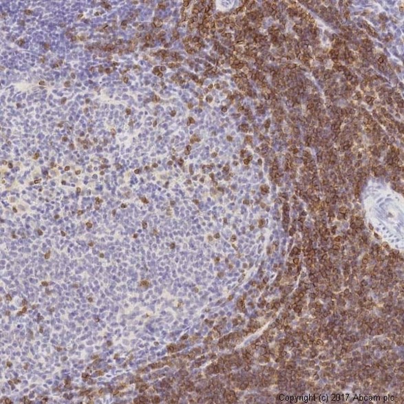 Immunohistochemistry (Formalin/PFA-fixed paraffin-embedded sections) - Anti-CD3 epsilon antibody [SP7] - BSA and Azide free (AB205228), expandable thumbnail