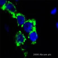 Immunohistochemistry (Formalin/PFA-fixed paraffin-embedded sections) - Anti-CD3 epsilon antibody [SP7] - BSA and Azide free (AB205228)