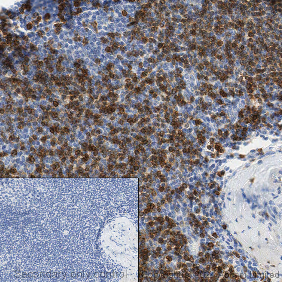 Immunohistochemistry (Formalin/PFA-fixed paraffin-embedded sections) - Anti-CD3 epsilon antibody [SP7] - BSA and Azide free (ab205228), expandable thumbnail