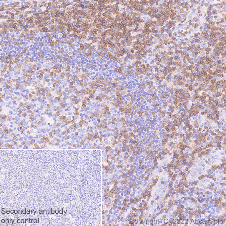Immunohistochemistry (Formalin/PFA-fixed paraffin-embedded sections) - Anti-CD3 epsilon antibody [SP7] - BSA and Azide free (AB205228)