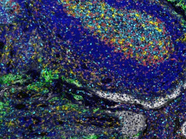 Multiplex immunohistochemistry - Anti-CD3 epsilon antibody [SP7] - BSA and Azide free (ab205228), expandable thumbnail