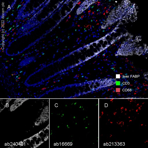Multiplex immunohistochemistry - Anti-CD3 epsilon antibody [SP7] - BSA and Azide free (ab205228), expandable thumbnail