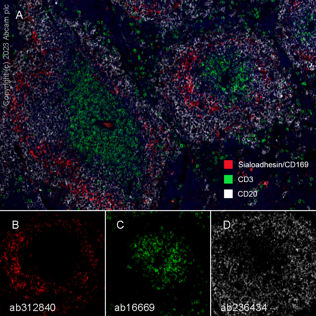 Multiplex immunohistochemistry - Anti-CD3 epsilon antibody [SP7] - BSA and Azide free (ab205228), expandable thumbnail