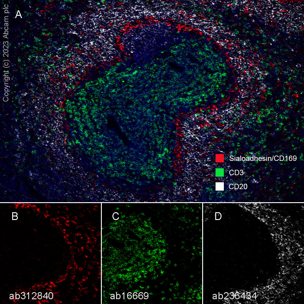 Multiplex immunohistochemistry - Anti-CD3 epsilon antibody [SP7] - BSA and Azide free (ab205228), expandable thumbnail