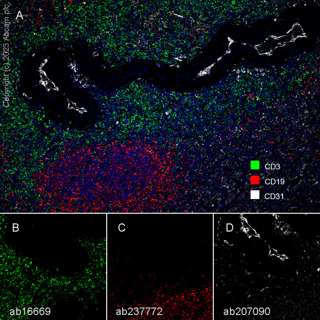 Multiplex immunohistochemistry - Anti-CD3 epsilon antibody [SP7] - BSA and Azide free (ab205228), expandable thumbnail