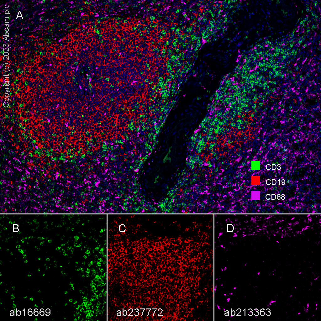 Multiplex immunohistochemistry - Anti-CD3 epsilon antibody [SP7] - BSA and Azide free (AB205228), expandable thumbnail