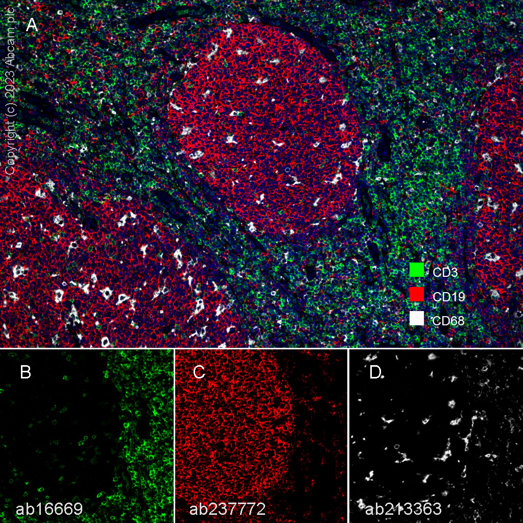 Multiplex immunohistochemistry - Anti-CD3 epsilon antibody [SP7] - BSA and Azide free (ab205228), expandable thumbnail