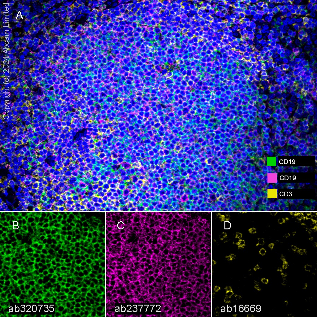 Multiplex immunohistochemistry - Anti-CD3 epsilon antibody [SP7] - BSA and Azide free (ab205228), expandable thumbnail