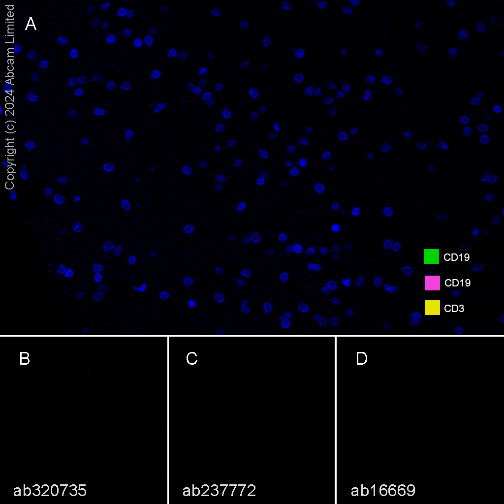 Multiplex immunohistochemistry - Anti-CD3 epsilon antibody [SP7] - BSA and Azide free (ab205228), expandable thumbnail
