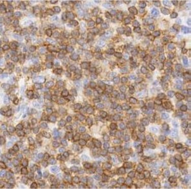 Immunohistochemistry (Formalin/PFA-fixed paraffin-embedded sections) - Anti-CD3 epsilon antibody [SP7], prediluted (AB21703), expandable thumbnail