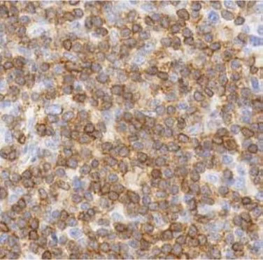 Immunohistochemistry (Formalin/PFA-fixed paraffin-embedded sections) - Anti-CD3 epsilon antibody [SP7], prediluted (AB21703)