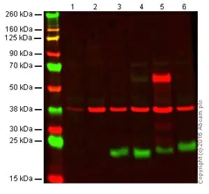 Western blot - Anti-CD3 epsilon antibody [SP7], prediluted (AB21703)